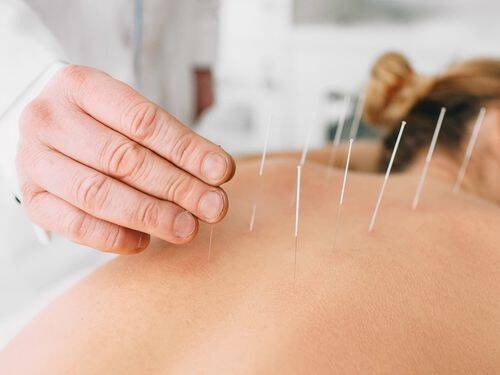 Akupunktura - czy wiesz jak mogą pomóc Ci te zabiegi?